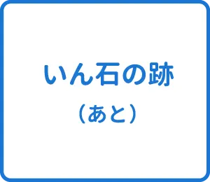選択肢